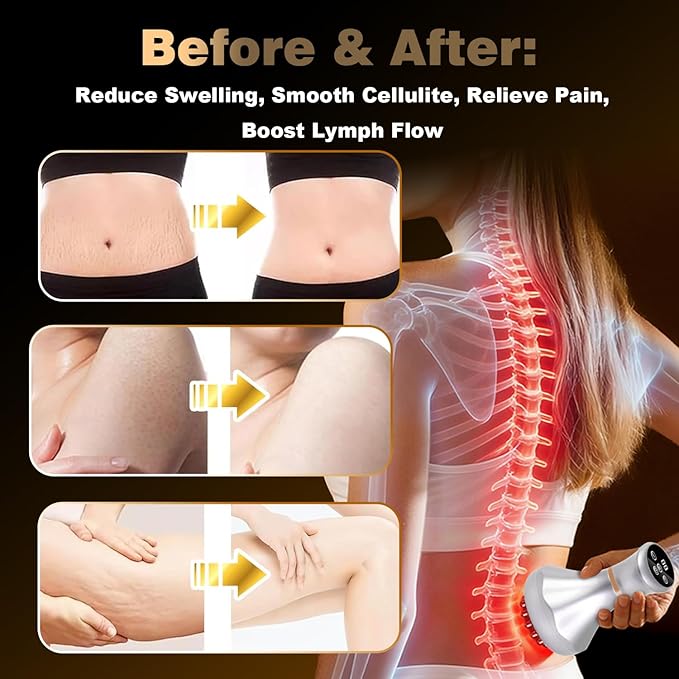 4-in-1 Lymphatic Drainage Massager - Anti Cellulite Massage Tool with Heating/Vibration/Red Light/Microcurrent,Body Sculpting Machine for Legs/Back/Hips Pain Relief/Reduce Stretch Marks & Cellulite