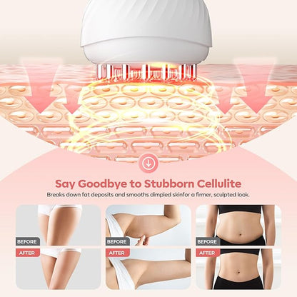 Lymphatic Drainage Massager & Anti Cellulite Massage Tool,New Lymphatic Massager,Helps Reduce Stretch Marks & Cellulite，for Belly, Arms & Legs,Body Sculpting Machine with Heat & Vibration