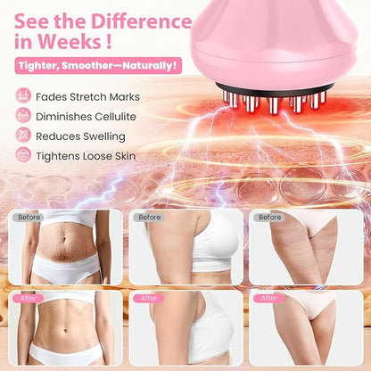 Lymphatic Drainage Massager, Anti Cellulite Massage Tool For Thigh & Belly Stretch Marks & Cellulite Reduction, Handheld Massage tools for Sciatica Nerve, Legs, Arms, Hip, Muscle, Low Back Pain Relief