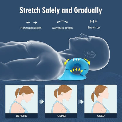 Neck Stretcher for Pain Relief, Neck and Shoulder Relaxer Cervical Traction Device Pillow for Muscle Relax and TMJ Pain Relief (Blue)