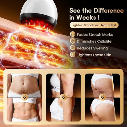 Lymphatic Drainage Massager & Anti Cellulite Massage Tool, Helps Reduce Stretch Marks & Cellulite, for Legs, Arms & Belly, Body Sculpting Machine with Microcurrent & Red-Light & Heat & Vibration