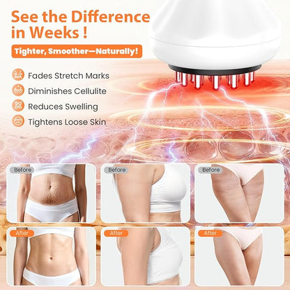 Lymphatic Drainage Massager, Anti-Cellulite Massager For Body Cellulite and Thigh & Belly Stretch Marks Reduction, Handheld Massage tools for lymphedema & lipedema, Sciatica Nerve pain relief Devices