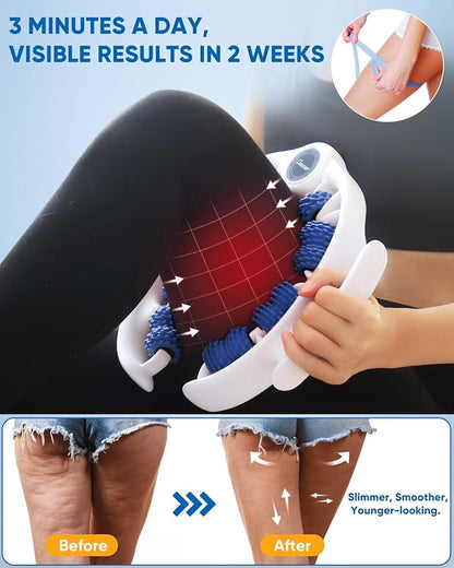 ONUEMP Cellulite Massage Tool, Lymphatic Drainage Cellulite Remover for Legs, Muscle Roller Fascia Massage - Body Sculpting, Lipedema Massagers, Celulitis Reduccion, Deep Tissue Pain Relief, Blue