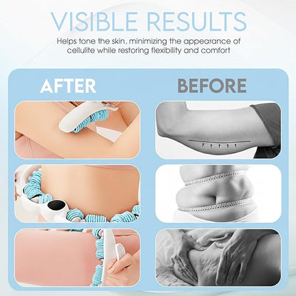 Cellulite Massage Roller, Fascia Blaster, Lymphatic Drainage Massager, Relieve Muscle Soreness, Body Sculpting Tool with Detachable Handles for Thighs, Legs, Buttocks, Gift Exfoliating Brush (Blue)