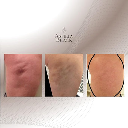 Nugget by Ashley Black - Deep Tissue Muscle Therapy for Athletes - Full Body Massage and Recovery Tool