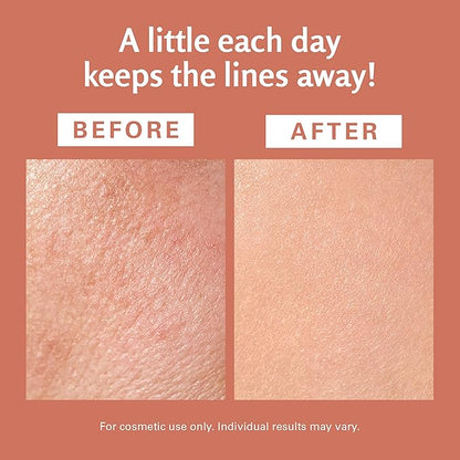 Frankincense Essential Massage Oil for Scars, Stretch Marks & Fine Lines, Firming, Hydrating, Smoothing & Calming Formula with Collagen, Stem Cells, Lavender & Grapefruit, 8 fl oz, by M3
